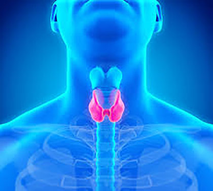 Hypothyroidism
