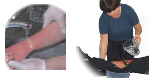 Be Aware & Take Care - Treat Simple Emergencies with Simple Aid