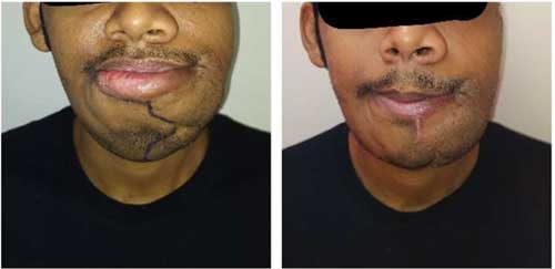 Plastic Surgery