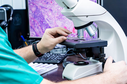 Screening Tests for Cancers in the Elderly