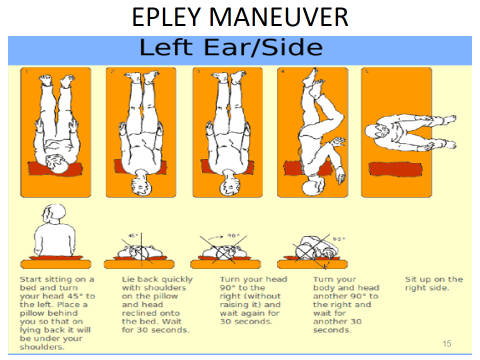 Benign Paroxysmal Positional Vertigo BPPV A Case Series Kauvery 