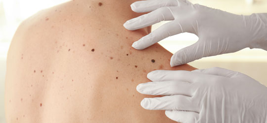 dermatologist