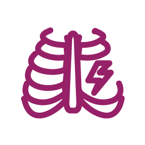 Pain radiating to the rib cage or trunk of the body