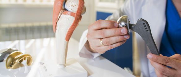 joint replacement