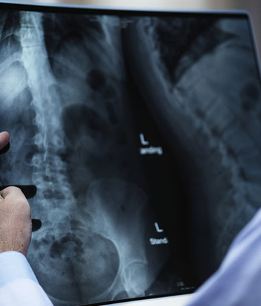 Factors that affect Bone Health