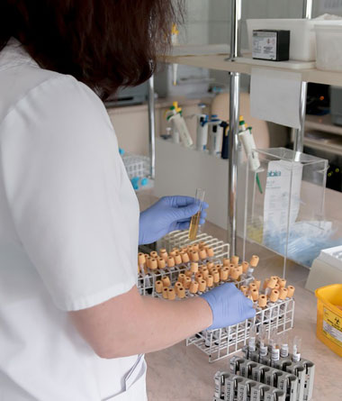 What is a Cardiac Enzyme Test?