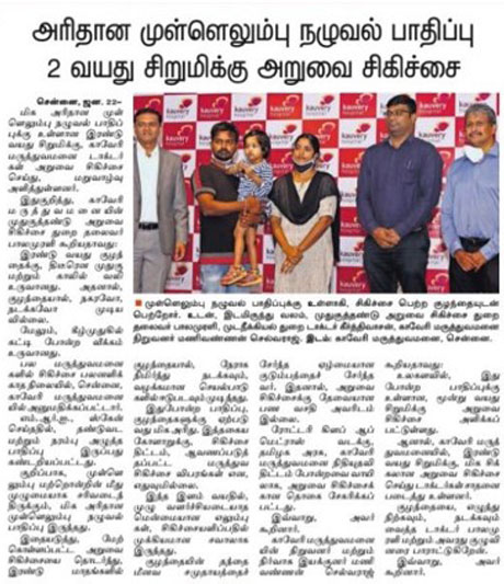2 year old girl treated for rare spine disorder - Press meet