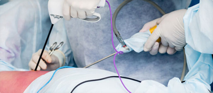 surgical oncology