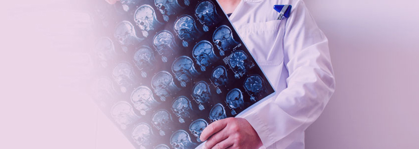Encephalopathy 