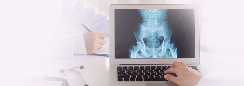 Paraplegia