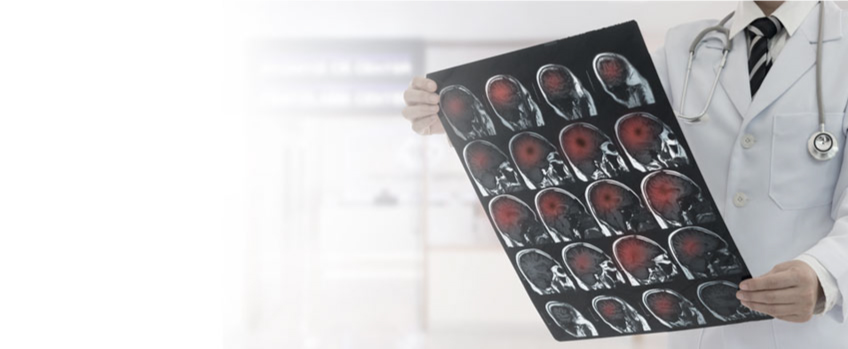 Cranial Gunshot Wounds