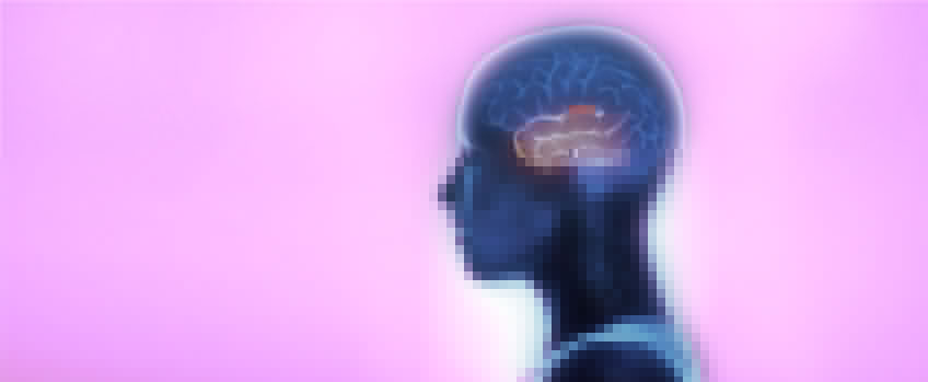 Other Extra Temporal Lobe Epilepsies
