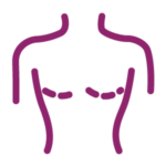 breast conserving surgery