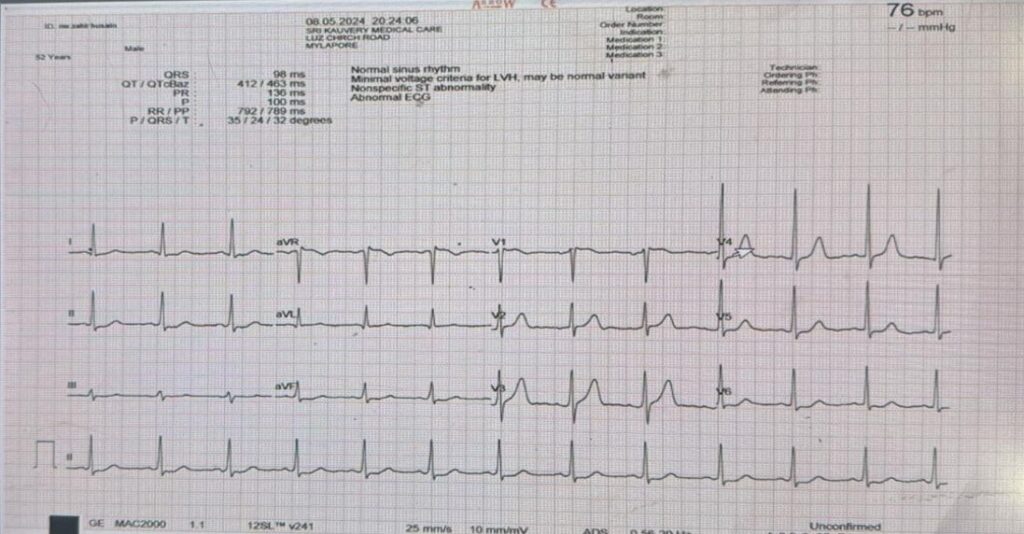 When the vessels of vessel bleed: A case of aortic intramural hematoma ...