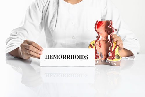 Anorectal Conditions in Women