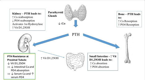 Primary Hyperparathyroidism: Misunderstood and Underdiagnosed