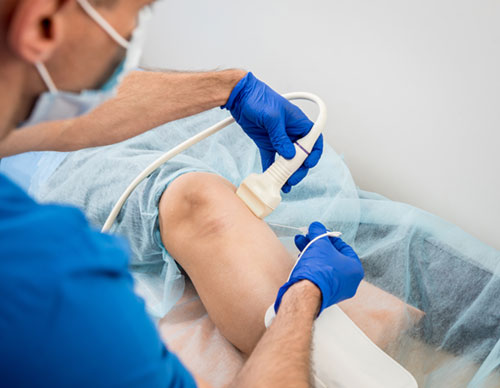 Radio Frequency Ablation in Chronic Pain Conditions