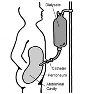 Peritoneal Cavity