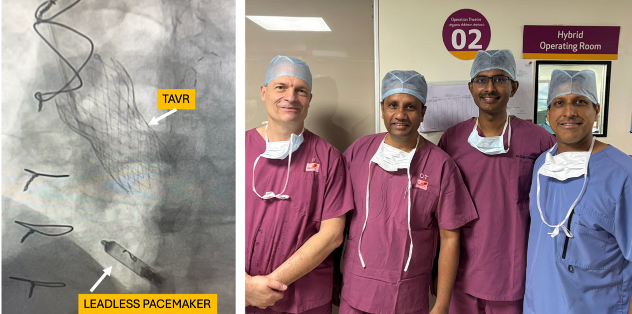 Latest generation of Leadless pacemakers AVEIRTM