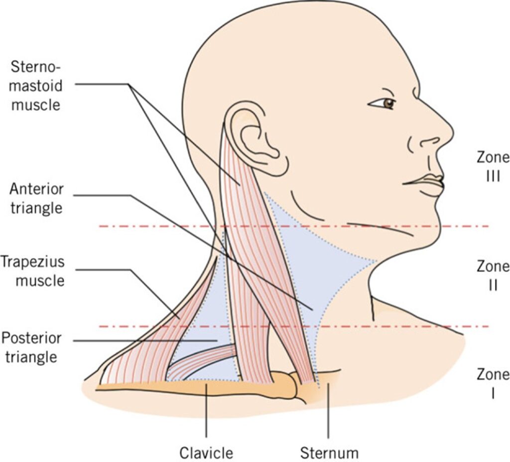 Penetrating neck trauma - Kauvery Hospital