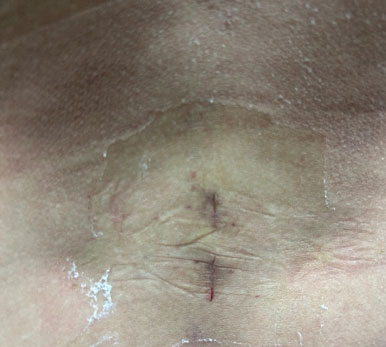 Understanding Minimally Invasive Brain and Spine Surgery - Appropriate Technology