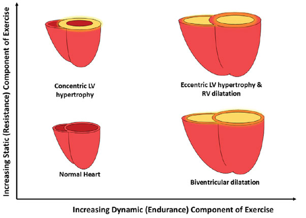 Advanced Imaging in Sports Cardiology