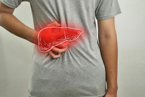 What Is Fatty Liver Disease?